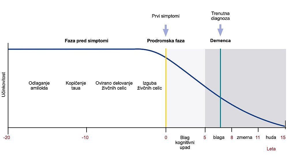 Stopnje Alzheimerjeve bolezni: diagram prikazuje, da sta pri Alzheimerjevi bolezni pred stopnjo demence predsimptomatska stopnja (z odlaganjem amiloida, agregacijo tau-a, oslabljenim delovanjem živčnih celic in izgubo živčnih celic) in prodromalna stopnja. Kognitivna zmogljivost začne upadati šele v prodromalni fazi. Padajoča črta prikazuje delovanje bolnika.